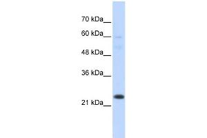 WB Suggested Anti-TAF12 Antibody Titration:  0.