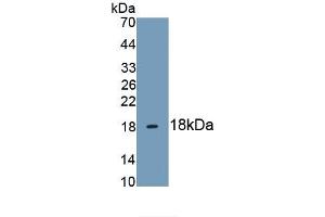 Detection of Recombinant HBEGF, Human using Monoclonal Antibody to Heparin Binding Epidermal Growth Factor Like Growth Factor (HBEGF) (HBEGF antibody  (AA 21-160))