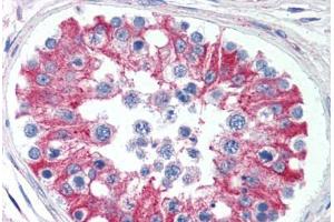 Human Testis (formalin-fixed, paraffin-embedded) stained with SMAD6 antibody ABIN295868 at 5 ug/ml followed by biotinylated goat anti-rabbit IgG secondary antibody ABIN481713, alkaline phosphatase-streptavidin and chromogen. (SMAD6 antibody  (AA 85-99))