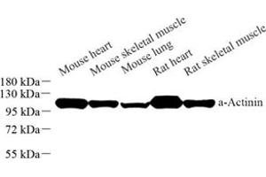 Western blot analysis of Sarcomeric α Actinin (ABIN7075510) at dilution of 1: 1000 (Sarcomeric alpha Actinin antibody)