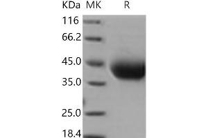 Western Blotting (WB) image for Interleukin 4 Receptor (IL4R) (Active) protein (His tag) (ABIN7196569) (IL4 Receptor Protein (His tag))