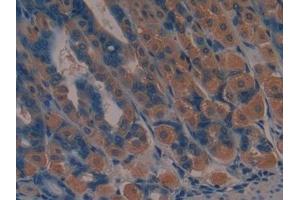 #VALUE! (JAG2 antibody  (AA 709-941))