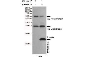 Immunoprecipitation analysis of Hela cell lysates using S100A4 mouse mAb. (s100a4 antibody)