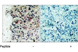 Image no. 1 for anti-Janus Kinase 1 (JAK1) (Tyr1022) antibody (ABIN197301) (JAK1 antibody  (Tyr1022))
