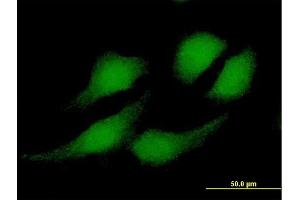 Immunofluorescence of purified MaxPab antibody to RBX1 on HeLa cell. (RBX1 antibody  (AA 1-108))