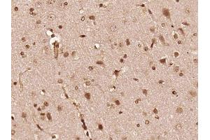 Paraformaldehyde-fixed, paraffin embedded rat brain, Antigen retrieval by boiling in sodium citrate buffer (pH6) for 15min, Block endogenous peroxidase by 3% hydrogen peroxide for 30 minutes,  Blocking buffer (normal goat serum) at 37°C for 20min, Antibody incubation with FGFR1/FGFR2 (Tyr463/Tyr466) Antibody (bs-5326R) at 1:400 overnight at 4°C, followed by a conjugated secondary and DAB staining. (FGFR1/FGFR2 antibody  (pTyr463, pTyr466))