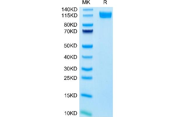 Selectin E/CD62e Protein (AA 22-556) (Fc Tag)