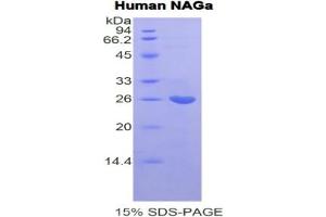 SDS-PAGE of Protein Standard from the Kit (Highly purified E.