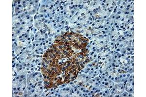 Immunohistochemical staining of paraffin-embedded Kidney tissue using anti-ATP5Bmouse monoclonal antibody. (ATP5B antibody)