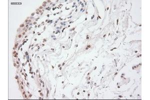 Immunohistochemical staining of paraffin-embedded lung tissue using anti-GAD1mouse monoclonal antibody. (GAD antibody)