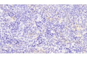 Detection of GM-CSF in Mouse Spleen Tissue using Polyclonal Antibody to Colony Stimulating Factor 2, Granulocyte Macrophage (GM-CSF) (GM-CSF antibody  (AA 19-141))