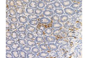 ABIN6255266 and ABIN6277952 at 1/100 staining Rat colon tissue by IHC-P. (PKM2 antibody  (pSer37))