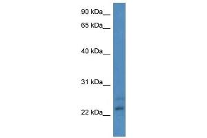 Western Blot showing CBR4 antibody used at a concentration of 1-2 ug/ml to detect its target protein. (CBR4 antibody  (N-Term))
