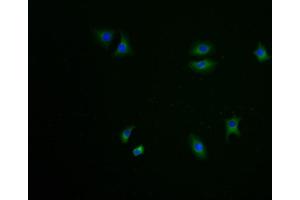 Immunofluorescence staining of A549 cells with ABIN7174940-IF at 1:100, counter-stained with DAPI. (Uncharacterized Protein SMIM29 (SMIM29) (AA 42-102) antibody)
