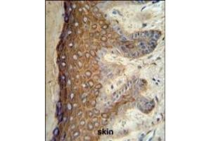 KRT1 Antibody (Center) (ABIN653648 and ABIN2842989) IHC analysis in formalin fixed and paraffin embedded skin tissue followed by peroxidase conjugation of the secondary antibody and DAB staining. (Cytokeratin 1 antibody  (AA 415-443))