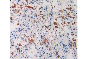 Used in DAB staining on fromalin fixed paraffin- embedded lung tissue (IL1RAP antibody  (AA 65-249))
