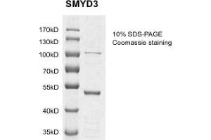 SMYD3 Protein (DYKDDDDK Tag)