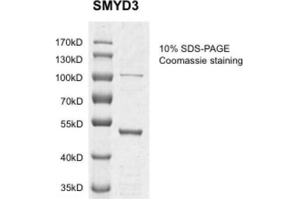 SMYD3 Protein (DYKDDDDK Tag)