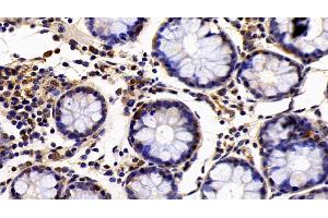 Detection of EP300 in Human Colon Tissue using Polyclonal Antibody to E1A Binding Protein P300 (EP300) (p300 antibody  (AA 1351-1601))