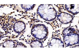 Detection of EP300 in Human Colon Tissue using Polyclonal Antibody to E1A Binding Protein P300 (EP300)