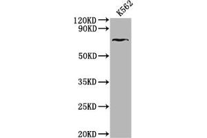 Western Blot Positive WB detected in: K562 whole cell lysate All lanes: HHIP antibody at 1:2000 Secondary Goat polyclonal to rabbit IgG at 1/50000 dilution Predicted band size: 79, 37 kDa Observed band size: 79 kDa (HHIP antibody  (AA 183-424))