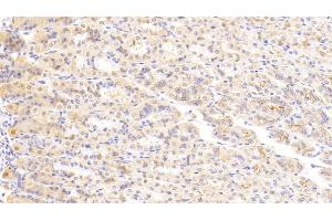 Detection of LAMa2 in Mouse Stomach Tissue using Polyclonal Antibody to Laminin Alpha 2 (LAMa2) (Laminin antibody  (AA 2901-3106))