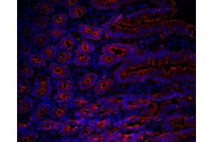 human duodenum (courtesy of L. (Cytokeratin 19 antibody)