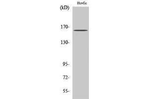 Western Blotting (WB) image for anti-Breakpoint Cluster Region (BCR) (Ser178) antibody (ABIN3183509)