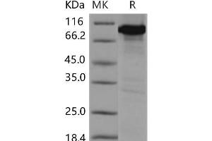 Western Blotting (WB) image for Calcium/calmodulin-Dependent Protein Kinase IV (CAMK4) protein (GST tag,His tag) (ABIN7320129) (CAMK4 Protein (GST tag,His tag))