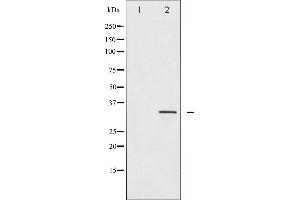Western blot analysis of IGFBP-3 expression in HuvEc whole cell lysates,The lane on the left is treated with the antigen-specific peptide. (IGFBP3 antibody  (Internal Region))