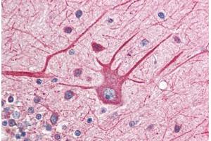 Human Brain, Cerebellum (formalin-fixed, paraffin-embedded) stained with EIF2AK2 antibody ABIN214488 at 2. (EIF2AK2 antibody  (C-Term))