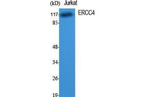 Western Blot (WB) analysis of specific cells using ERCC4 Polyclonal Antibody.