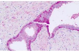 Human, Prostate: Formalin-Fixed Paraffin-Embedded (FFPE)