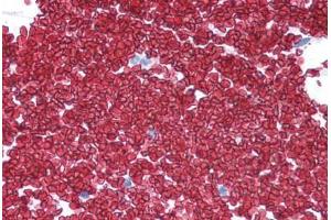 Human Colon, Erythrocytes (formalin-fixed, paraffin-embedded) stained with SLC2A1 antibody ABIN307185 at 5 ug/ml followed by biotinylated goat anti-rabbit IgG secondary antibody ABIN481713, alkaline phosphatase-streptavidin and chromogen.