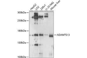 Western blot analysis of extracts of various cell lines, using  antibody (ABIN6129875, ABIN6136541, ABIN6136542 and ABIN6224558) at 1:1000 dilution.