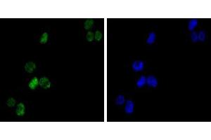 Immunofluorescence analysis of K562(left) cells using GATA1 mouse mAb (green). (GATA1 antibody)