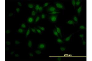 Immunofluorescence of monoclonal antibody to PPIL4 on HeLa cell. (PPIL4 antibody  (AA 395-466))