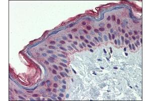 Human Skin: Formalin-Fixed, Paraffin-Embedded (FFPE) (MMP3 antibody  (Ser373))