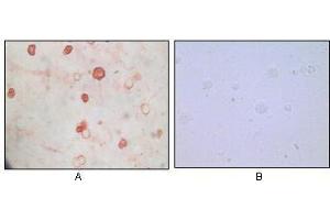 Immunocytochemistry analysis of TPA induced BCBL-1 cells (A) and uninduced BCBL-1 cells (B) using KSHV K8a antibody with AEC staining. (KSHV K8 alpha antibody)