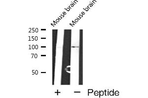 Western blot analysis of GluR6 expression in Mouse brain extracts (Metabotropic Glutamate Receptor 6 antibody  (C-Term))