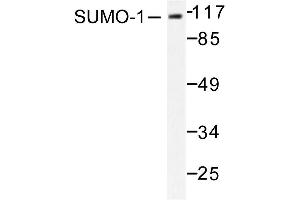 Image no. 1 for anti-Small Ubiquitin Related Modifier Protein 1 (SUMO1) antibody (ABIN271962) (SUMO1 antibody)