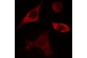ABIN6275359 staining Hela cells by IF/ICC. (Phospholipase D4 antibody  (C-Term))