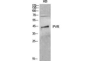 Western Blot (WB) analysis of KB cells using CD155 Polyclonal Antibody. (Poliovirus Receptor antibody  (Internal Region))