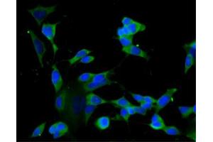 Immunofluorescence staining of undifferentiated SH-SY5Y cells (Human neuroblastoma, ATCC CRL-2266) (left) and differentiated SH-SY5Y cells (right). (GRIP1 antibody  (AA 877-1067))