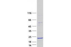 Validation with Western Blot