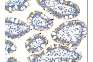 Image no. 1 for anti-Splicing Factor 3b, Subunit 4, 49kDa (SF3B4) (N-Term) antibody (ABIN202492) (SF3B4 antibody  (N-Term))
