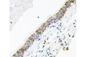 Immunohistochemistry of paraffin-embedded Human lung using ACVR2A Polyclonal Antibody at dilution of 1:100 (40x lens). (ACVR2A antibody)
