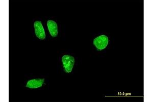 Immunofluorescence of monoclonal antibody to MAP2K7 on HeLa cell. (MAP2K7 antibody  (AA 1-99))