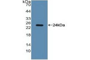 Western blot analysis of recombinant Human NCL. (Nucleolin antibody  (AA 388-569))