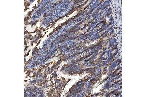 IHC analysis of TXNDC5 using anti-TXNDC5 antibody (ABIN7599699). (TXNDC5 antibody  (AA 109-403))